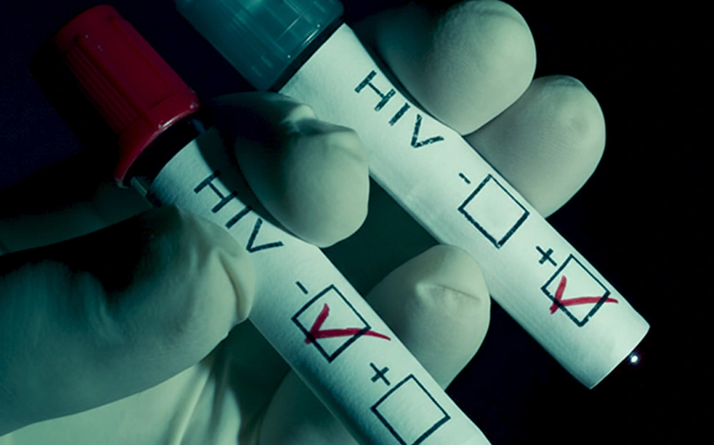 سریعترین آزمایش ایدز در ایران